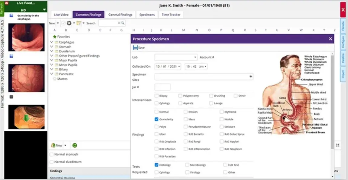 gGastro EHR & Endoscopy Report Writer Software EHR and Practice Management Software