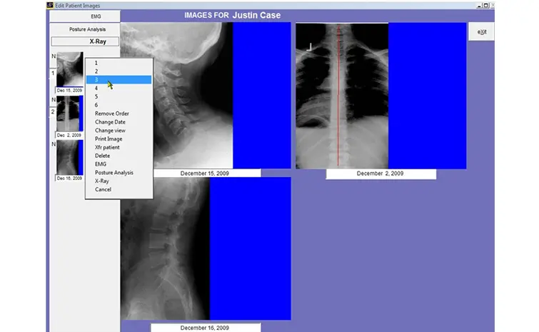 Atlas Chiropractic EMR Software EHR and Practice Management Software