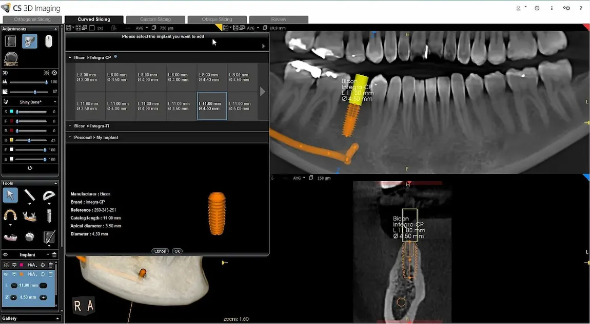 Carestream Dental EMR Software EHR and Practice Management Software