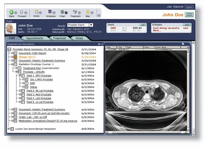 MOSAIQ EMR Software EHR and Practice Management Software